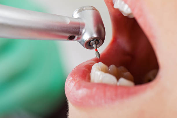 Best Emergency Cosmetic Dentistry (e.g., broken veneers) in Austin, TX